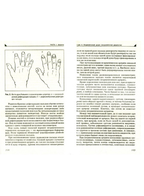 Артрит. Избавляемся от болей в суставах. Евдокименко П.В.