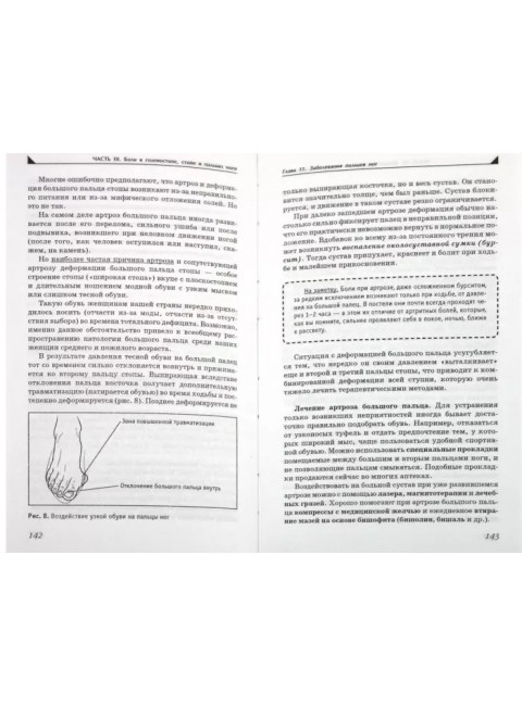 Боль в ногах. Что нужно знать о своем заболевании. Евдокименк