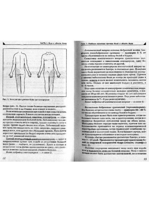 Боль в ногах. Что нужно знать о своем заболевании. Евдокименк