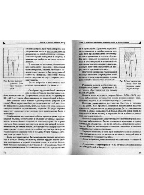 Боль в ногах. Что нужно знать о своем заболевании. Евдокименк