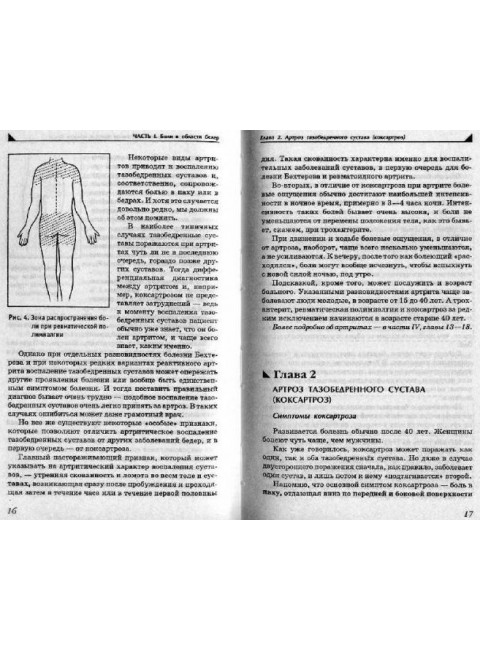Боль в ногах. Что нужно знать о своем заболевании. Евдокименк